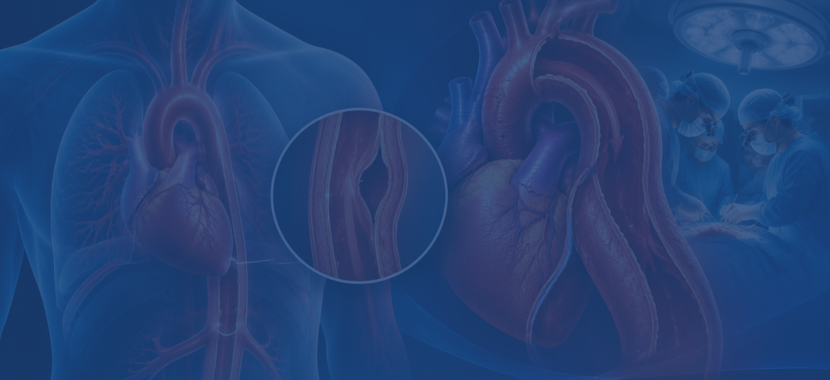 Aortic Dissection Type A Surgery