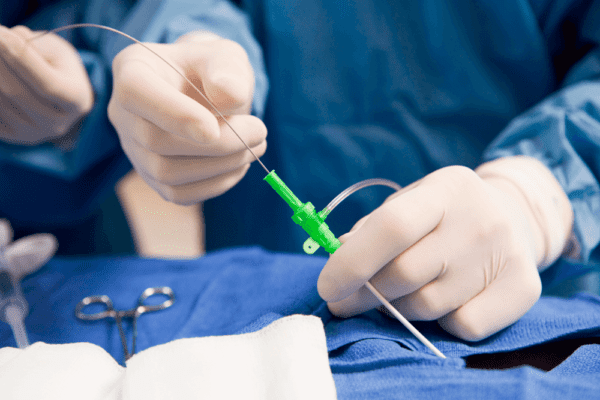 Aortic Root Replacement Surgery in Mumbai,India