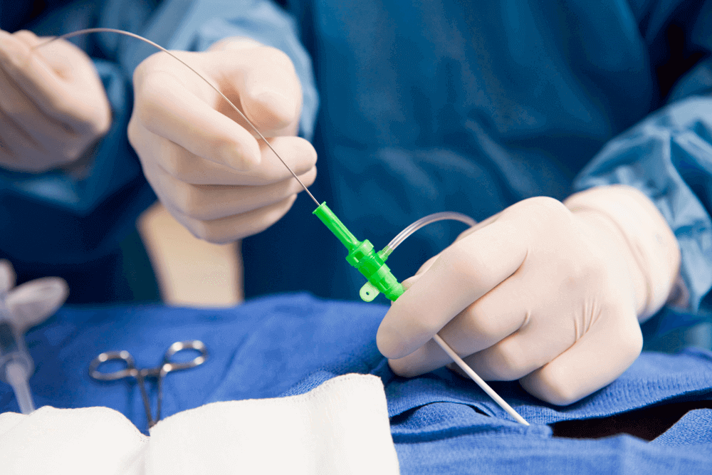 Aortic Root Replacement Surgery