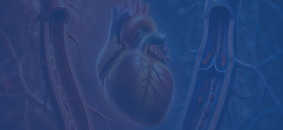Arterial Vs Vein Grafts In Cabg