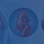 Ascending Aortic Aneurysm 5.5 Cm Surgery