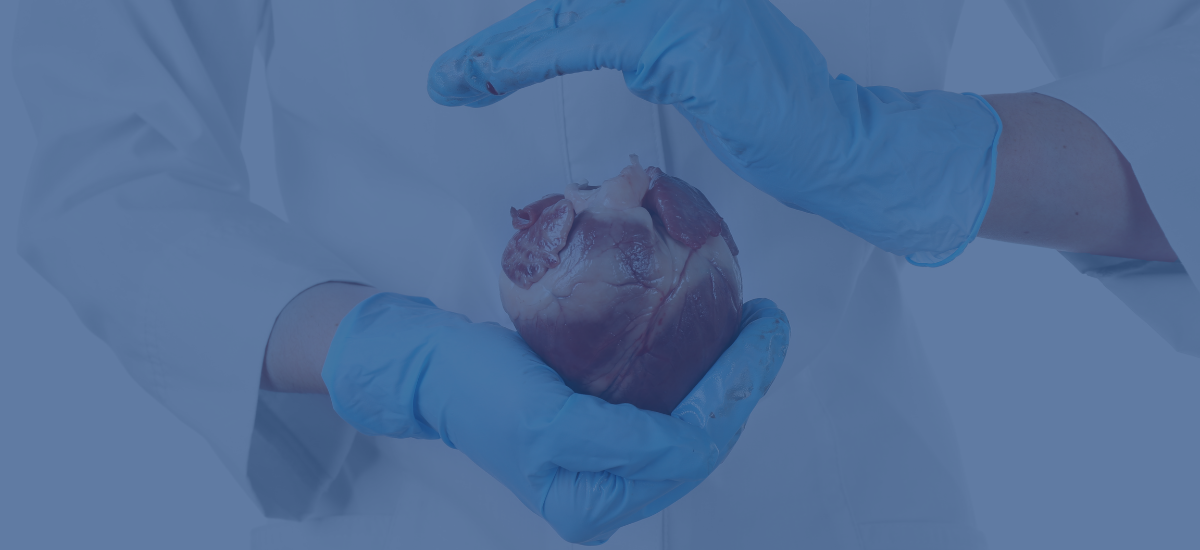 Average Life Expectancy After Heart Transplant What Patients Should Know (2)