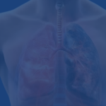 Can You Survive End Stage Copd What A Lung Transplant Can And Cannot Offer