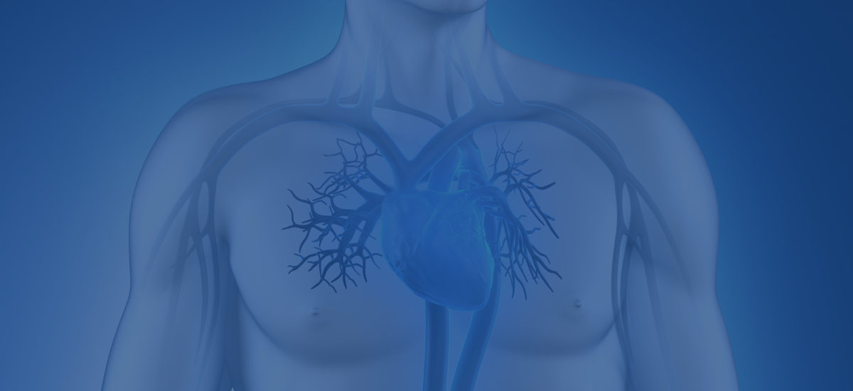 Cardiomyopathy Dr. Vishal Khullar