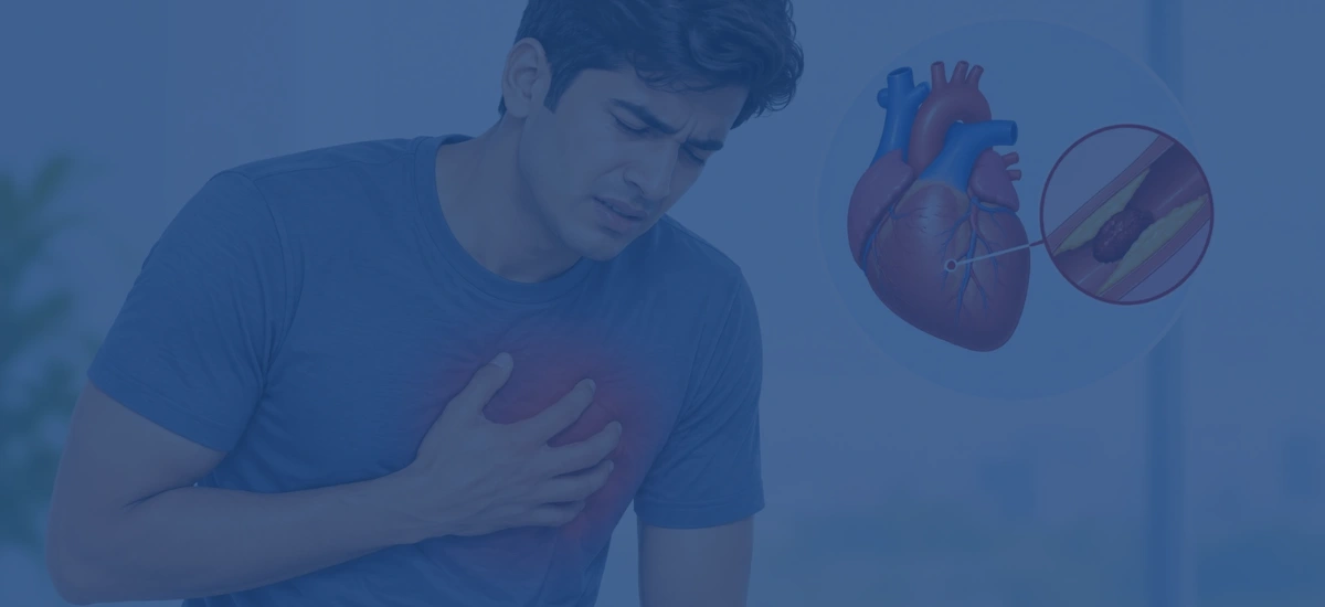 Causes Of Heart Attack In Young Age Tips To Avoid | Dr. Vishal Khullar Causes Of Heart Attack In Young Age Tips To Avoid