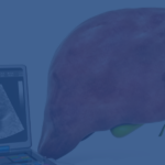How Does A Heart Lung Machine Work