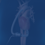 Living And Caring For Yourself With An Lvad Living And Caring For Yourself With An Lvad