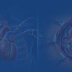 Minimally Invasive vs Open Heart Surgery: Which Is Safer