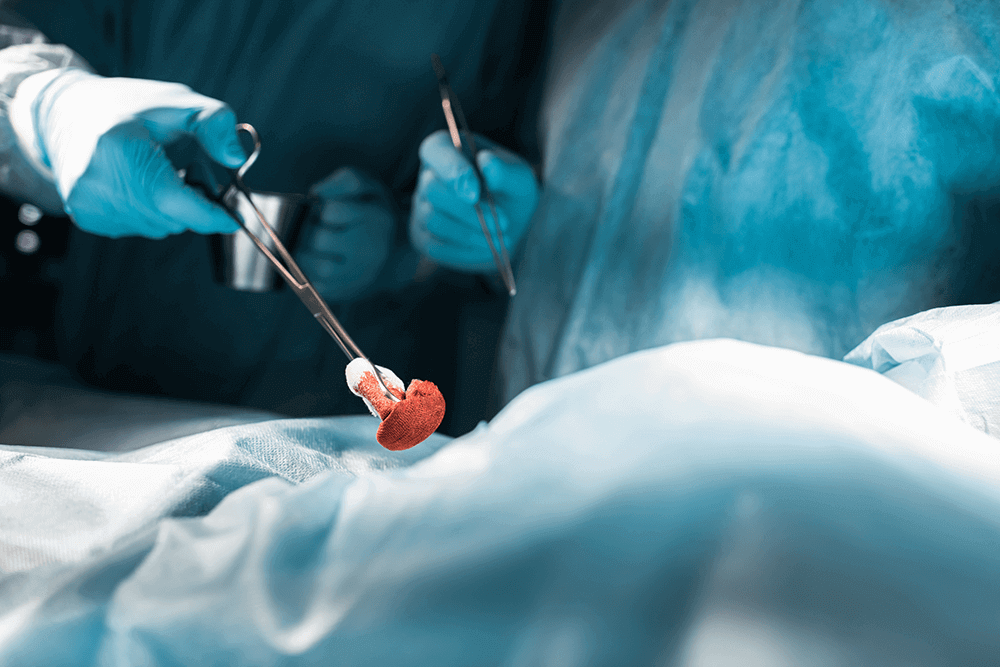 Mitral Valve Repair & Replacement Surgery