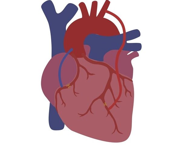 How Coronary Artery Bypass Graft Surgery Improves Blood Flow