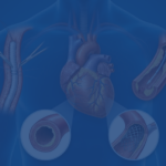 Redo Bypass vs Angioplasty: Which for Blocked Grafts