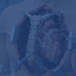 Redo Sternotomy Risk How Many Prior Surgeries Is Too Many
