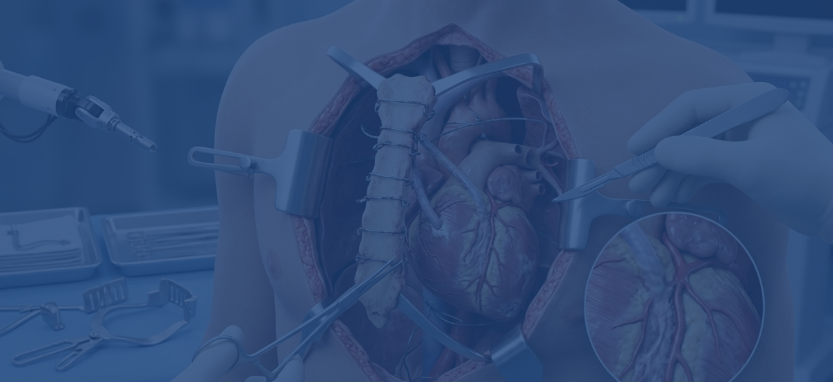 Redo Sternotomy Risk How Many Prior Surgeries Is Too Many
