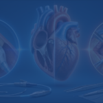 Tavr Vs Surgical Avr Which For Patients Under 65
