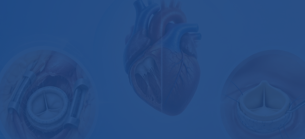 Tricuspid Repair vs Replacement: Which Is Better