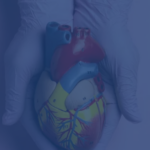 Week By Week Recovery After Heart Surgery Week By Week Recovery After Heart Surgery