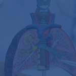 What Does A Lung Transplant Cost In India