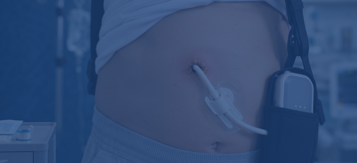 What Is An Lvad Driveline Infection