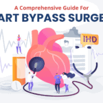 A Comprehensive Guide For Heart Bypass Surgery