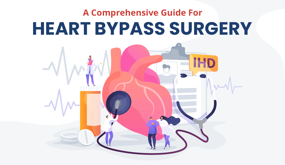 A Comprehensive Guide For Heart Bypass Surgery