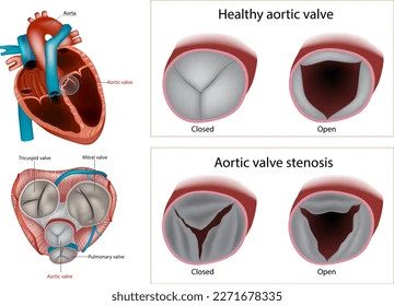 four heart valves