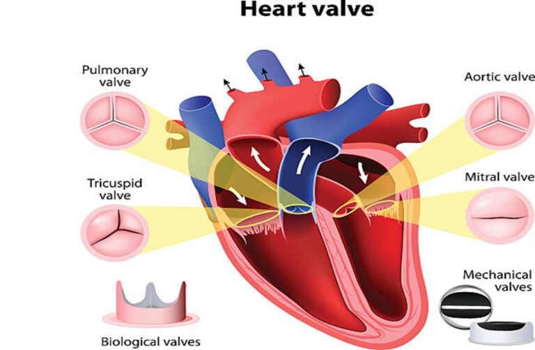 Heart Valve